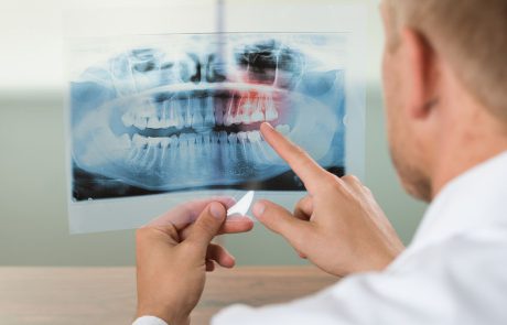 נזק חמור בעקבות טיפול ליישור שיניים? ייתכן שמדובר ברשלנות רפואית